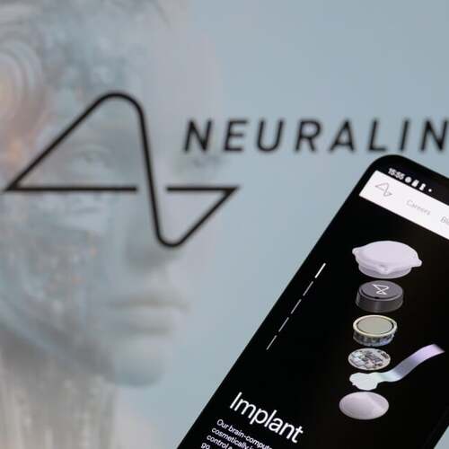 7 People Now Have Elon Musk's Neuralink Brain Implant